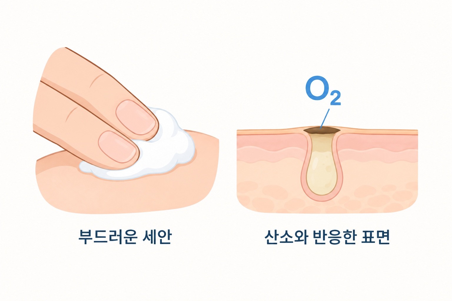 손끝의 부드러운 세안과, 산소와 반응해 표면이 검게 보이는 개방면포의 단면